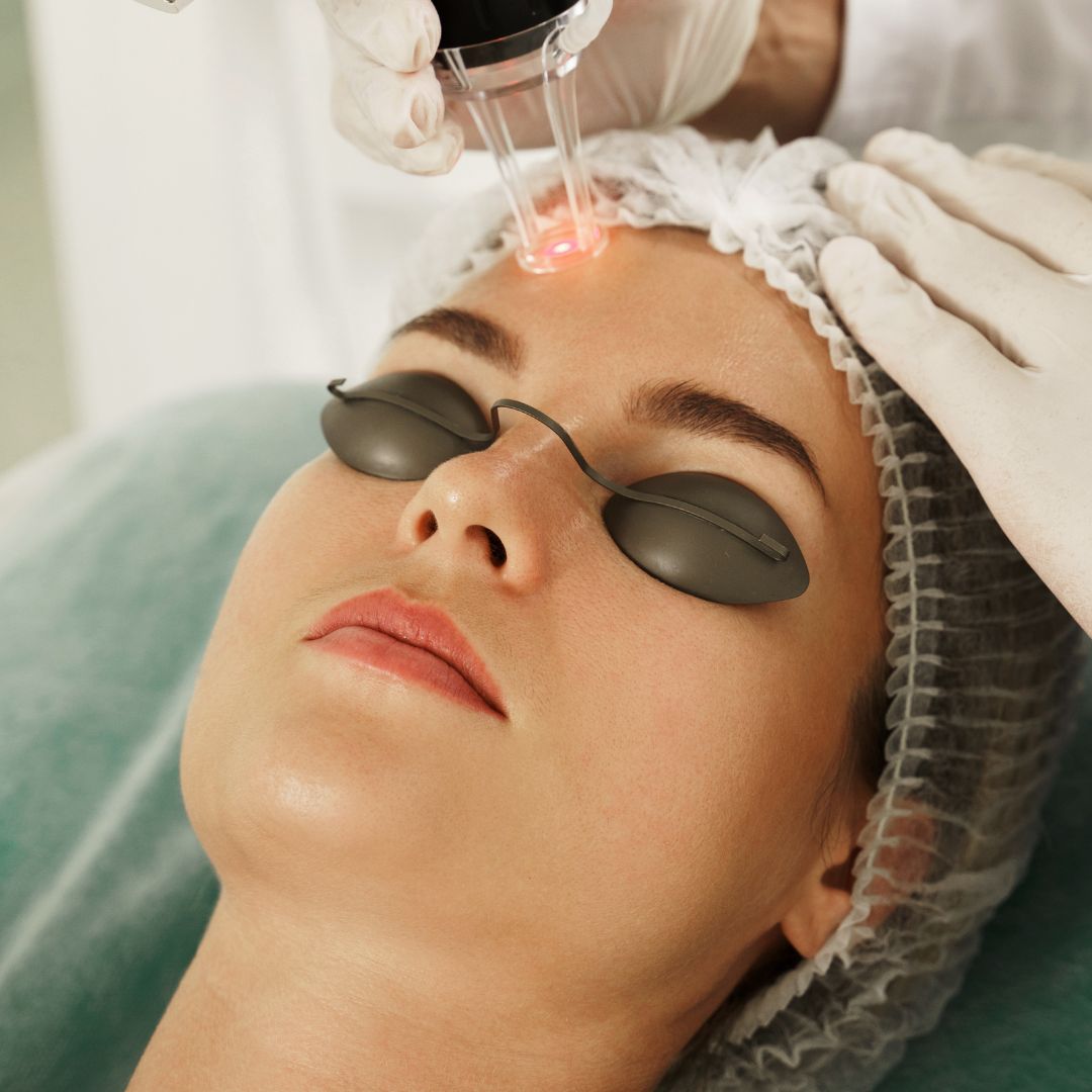 CLARA RIBEIRO DERMATOUltraformer Lifting Sem Cirurgia CLARA RIBEIRO DERMATOLOGIA estética em petropolis2