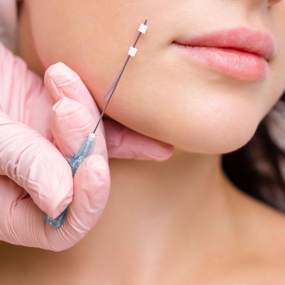 fios pdo clara ribeiro dermatologia